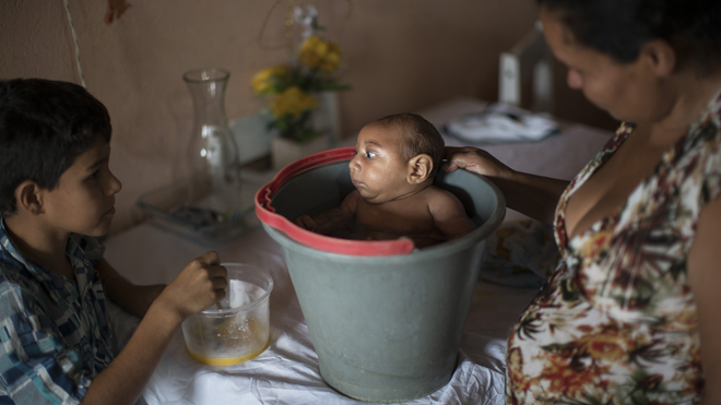 In this Dec. 23, 2015 photo, 10-year-old Elison, left, watches as his mother Solange Ferreira bathes Jose Wesley in a bucket at their house in Poco Fundo, Pernambuco state, Brazil. Ferreira says Jose Wesley enjoys being in the water, she places him in the bucket several times a day to calm him. (AP Photo/Felipe Dana)